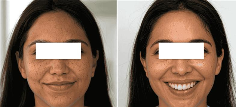 Eyebrows with Microblading